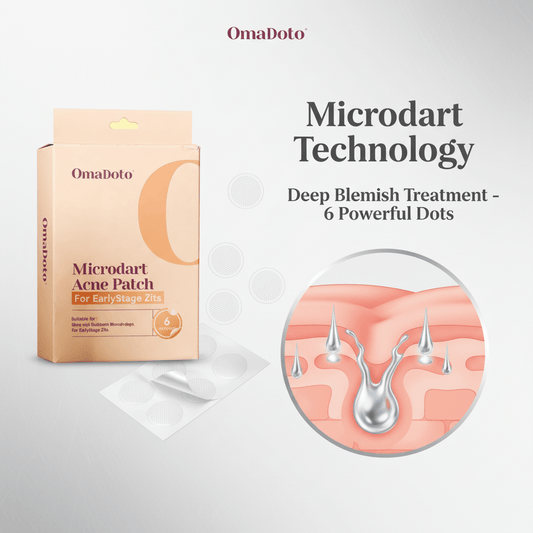 Microdart Pimple Patches: Revolutionary Deep-Treatment Solution for Stubborn Acne