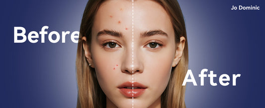 How to Use Pimple Patches: Complete Guide for Best Results