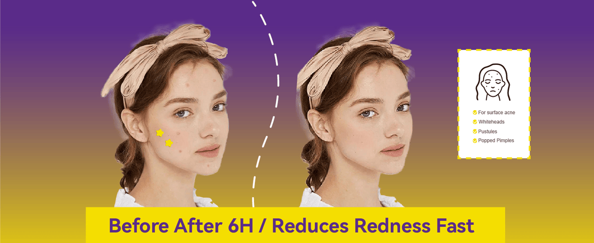 COMPARISON OF USAGE EFFECTS