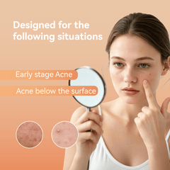 Deep Blemish Microdarts (6 Dots)