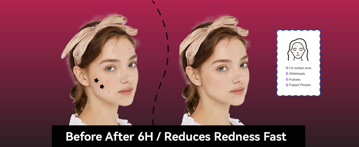 COMPARISON OF USAGE EFFECTS