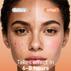 Deep Blemish Microdarts (6 Dots)