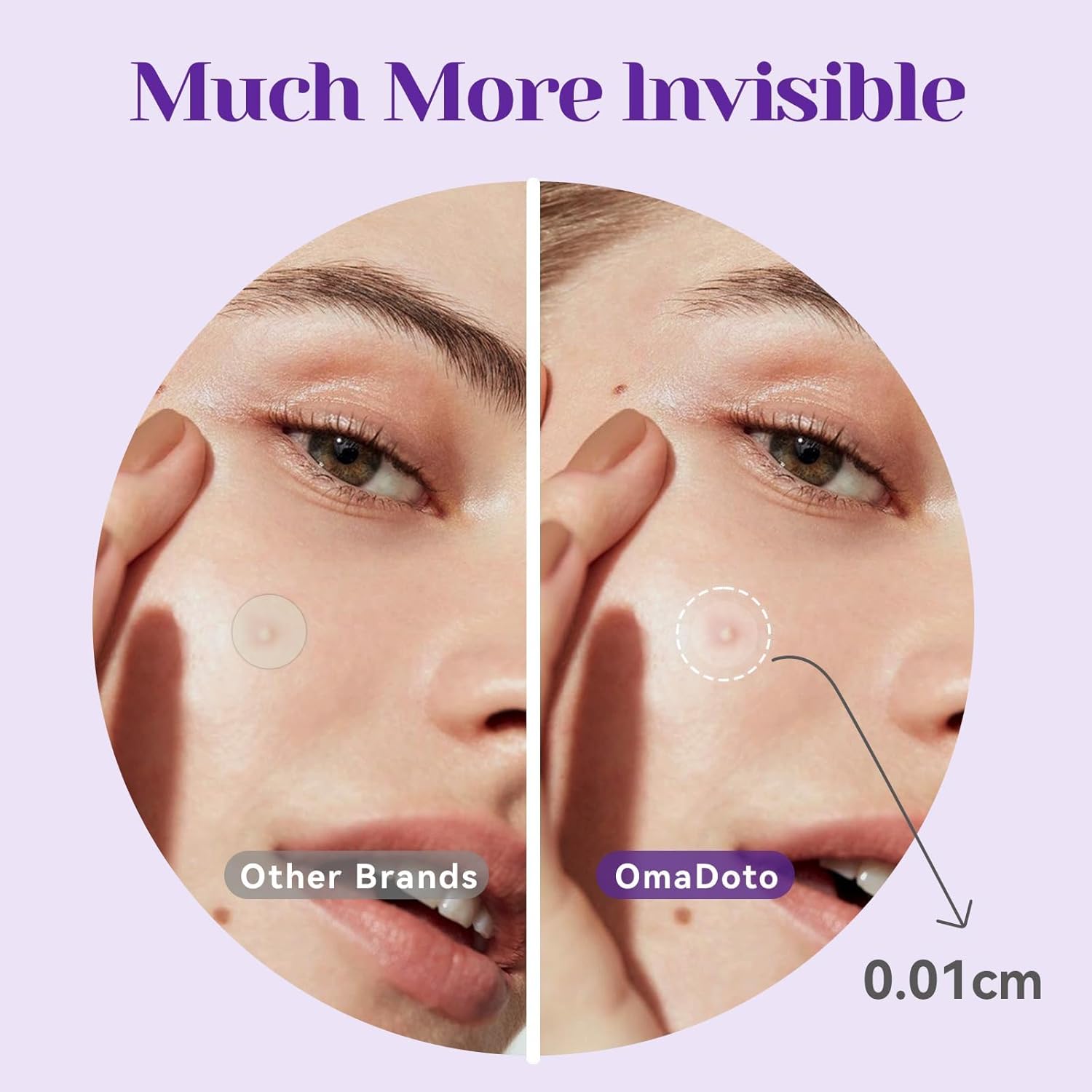 Omadoto Acne Patches - Overnight Pimple Treatment (72 Count) - OmaCare