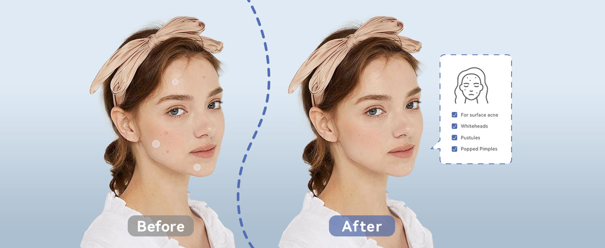 EFFECTS COMPARISON OF USAGE