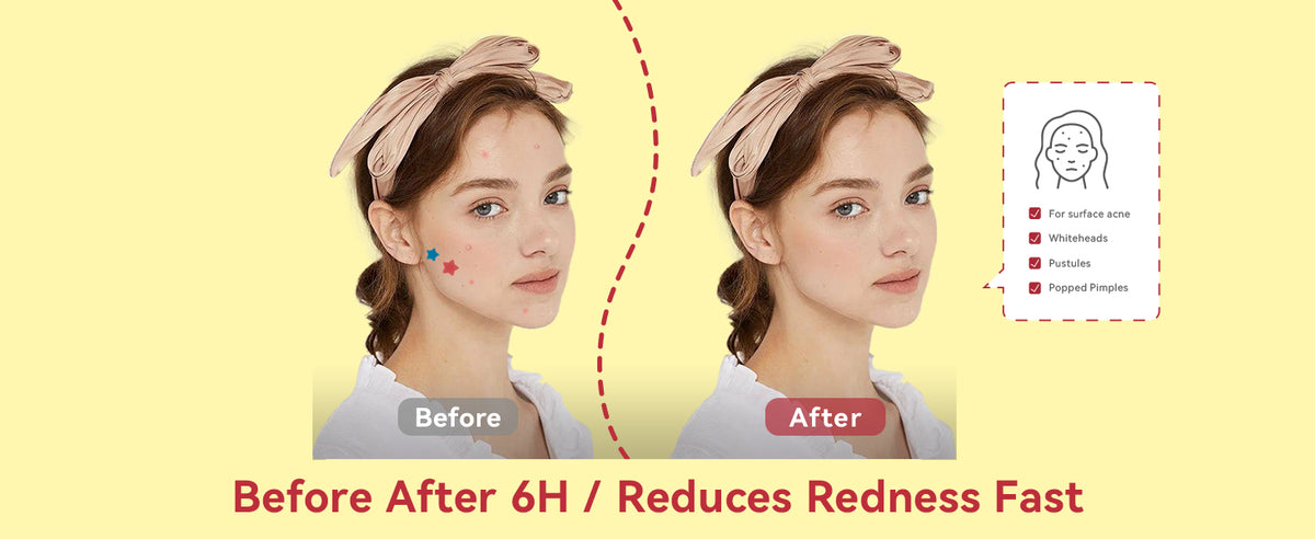 COMPARISON OF USAGE EFFECTS