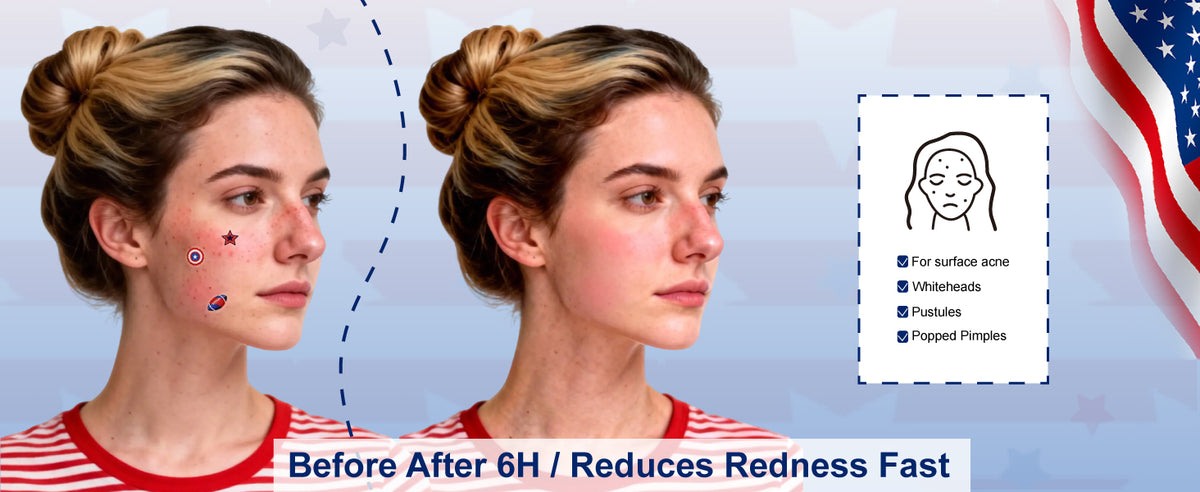 COMPARISON OF USAGE EFFECTS